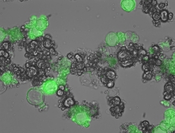 MIT researchers designed these particles that can produce proteins when ultraviolet light is shone on them. In this case, the protein is green fluorescent protein.