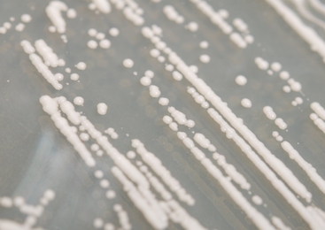 Yeast colonies shown close up.