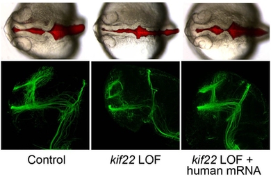 Zebrafish with certain genes turned off during embryonic development (center and right images) showed abnormalities of brain formation (top row) and axon wiring (bottom row). At left is a normally developing zebrafish embryo.