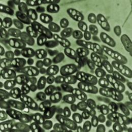 Micrograph shows a group of <i>Ralstonia eutropha</i> bacteria in culture. In their natural form, as seen here, the microbes convert carbon in their surrounding into a kind of bioplastic — seen as the light-colored dots inside their membranes. But a biologically engineered version developed at MIT instead produces isobutanol fuel, which is then expelled from the cells into the surrounding medium...