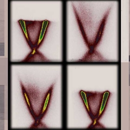 Three-dimensional graphical representations of the way electrons respond to an input of energy, delivered by a pulse of laser light. The horizontal axis represents the electrons' momentum, and the vertical axis shows their energy. The time sequence runs from top left to bottom right, and the laser pulse arrives just before the second image, causing a sudden burst of higher energy levels.