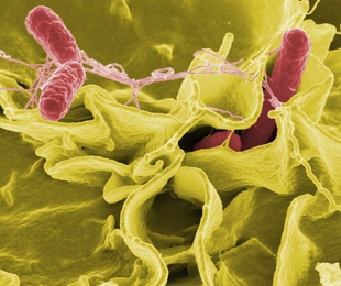 MIT biological engineers created new genetic circuits using genes found in Salmonella (seen here) and other bacteria.