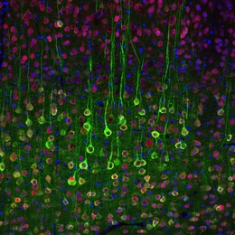 MIT neuroscientists used calcium imaging to label these pyramidal cells in the brain.