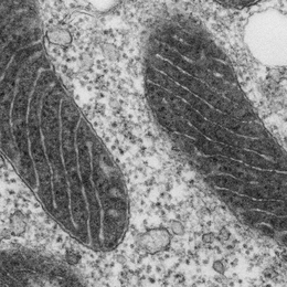 In this electron microscope image of a mitochondrion, the matrix has been stained with APEX, making it appear dark. The lighter projections into the matrix represent the intermembrane space.