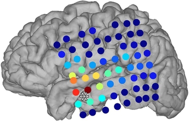 The colored dots in this image represent locations of the electrodes used to measure brain activity. As the brain wave oscillations become more asynchronous relative to the position of the star, the colors fade from red to blue.