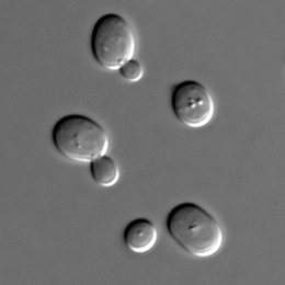 <i>Sacharomyces cerevisiae</i> cells in DIC microscopy.