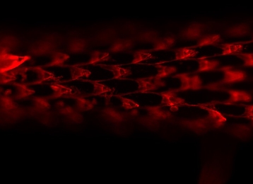 This fluorescent microscope image shows the tiny barbs that coat the tip of a porcupine's quills.