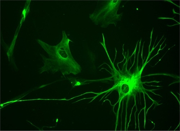 Neuroscientists have found that glial cells, which make up about half the cells in the brain, may play more than just a supporting role.
