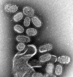 Electron microscopy of influenza virus