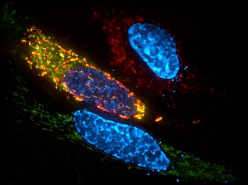 To determine the location of ALKBH7 in cells, MIT researchers engineered these cells to express ALKBH7 bound to green fluorescent protein (GFP). The cells’ mitochondria express a red fluorescent protein. In cells where ALKBH7 is present in the mitochondria, the green and red signals mix and appear yellow.