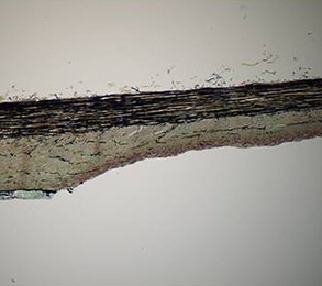 An artery wall, with pieces of the balloon's drug coating attached.