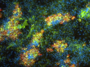 MIT researchers have generated mature liver cells from induced pluripotent stem cells. In this image, the cell nuclei are stained blue. The green stain identifies liver cells, and the red spots represent mature liver cells.