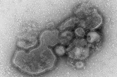 MIT researchers focused two recent studies on the H5N1 and H7N9 (shown) flu strains. 