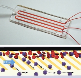 A microfluidic chip, like the one shown above, directly separates neutrophils from blood with ultrahigh purity and high efficiency without the need for cumbersome sample preparation. The chip works by mimicking the physiological process of &#39;cell rolling&#39; where patterns of adhesive molecules are used to draw out neutrophils (blue) from a stream of blood (red) into a parallel buffer stream a...