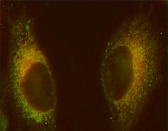 In these cells, mitochondria are labeled with a red fluorescent dye, and the platinum compound targeted to the mitochondria is labeled green. Areas where the two colors overlap, forming yellow, highlight the accumulation of platinum in the mitochondria.