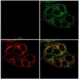 Fluorescence microscopy images of live cervical cancer cells pretreated with the sensor: (Top left) minimal fluorescence, reflecting low levels of mobile zinc ions; (top right) a bright green signal appears once zinc ions are taken into the cell; (bottom left) the red fluorescence signal indicating the location of mitochondria; (bottom right) an overlay of the zinc sensor signal and mitochondrial ...