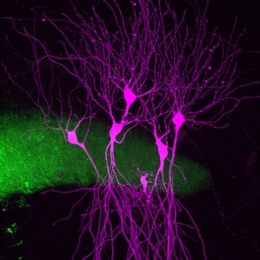 Mossy fibers (green) from dentate granule cells establish synaptic connections with CA2 pyramidal cells (violet).