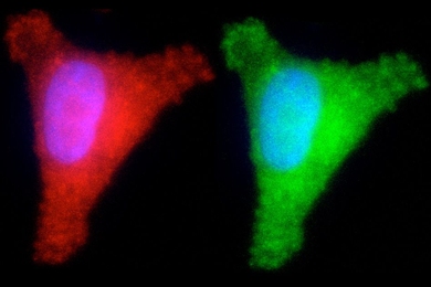 MIT biological engineers have developed a way to test several different DNA repair pathways in one cell. In each of these images, the cell is producing a different colored fluorescent protein, indicating whether it has successfully repaired one of four different types of DNA damage.