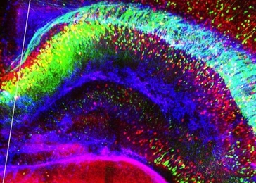 colorized image of brain tissue