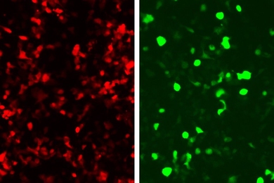 At left, cells glow red to indicate that the detection system has been successfully delivered. The system was designed to produce green fluorescence in cells carrying a viral DNA sequence, as seen at right.