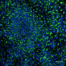 Human neuron progenitors express neural stem cell marker Nestin (green).