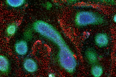 This image demonstrates tissue patterns that emerge from genetically programmed human pluripotent stem cells, and was taken on day nine of the MIT study. It shows immunostainings of cell nuclei for CEBPA (red, endodermal marker), SOX10 (green, ectodermal marker), and DAPI (blue, binds to DNA in the nucleus). 