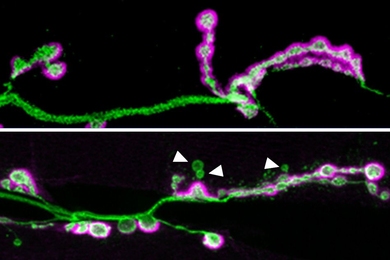 In the top image, a neuronal axon (green) forms many synapses, highlighted in purple. The bottom image shows an axon from a fruit fly lacking the Shank protein. In these flies, not as many synapses form, and some of them (indicated by the white arrows) do not fully mature.