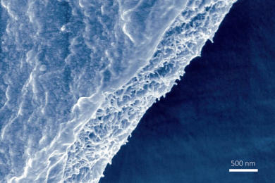 A scanning electron micrograph shows a free-standing Bombyx mori silk nanofibril membrane.