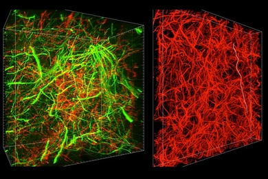 A new technique called magnified analysis of proteome (MAP), developed at MIT, allows researchers to peer at molecules within cells or take a wider view of the long-range connections between neurons.
