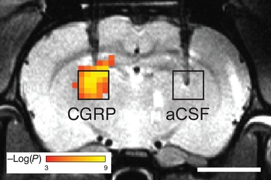 MIT researchers have designed protein-based sensors that can dilate blood vessels in the brain. This dilation can be imaged with magnetic resonance imaging (MRI), as seen on the left side of this scan. 