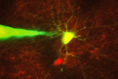 MIT engineers have devised a way to automate the process of monitoring neurons in a living brain using a computer algorithm that analyzes microscope images and guides a robotic arm to the target cell. In this image, a pipette guided by a robotic arm approaches a neuron identified with a fluorescent stain. 
