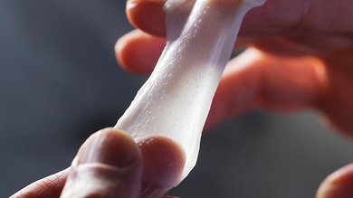 MIT alumnus Dennis Orgill developed a process of infusing scaffolds — collagen skin grafts — with healthy skin cells to promote a more effective regeneration. The scaffold was invented by Professor Ioannis Yannas. 