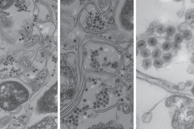 Electron microscope images of marine bacteria infected with the non-tailed viruses studied in this research. The bacterial cell walls are seen as long double lines, and the viruses are the small round objects with dark centers.
