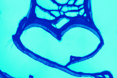 A recolored optical image obtained by MIT researchers shows a heart-shaped carbon nanotube cell. A version of the image is featured on the cover of the Feb. 14 print edition of Physical Chemistry Chemical Physics.