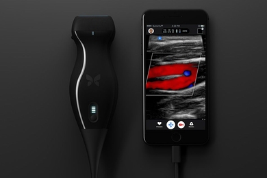 Butterfly Network, a startup co-founded by MIT alumnus Nevada Sanchez ’10, SM ’11, has developed a low-cost, handheld scanner that generates clinical-quality ultrasounds on a smartphone. Ultrasounds are uploaded to the cloud, where any expert with permission can give second opinions or help analyze images. 
