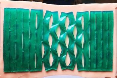 Ruike Zhao, a postdoc in MIT’s Department of Mechanical Engineering, says kirigami-patterned adhesives may enable a whole swath of products, from everyday medical bandages to wearable and soft electronics. 