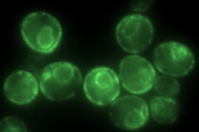 Fluorescently-tagged IAPP oligomers can be seen trafficking through yeast cells.