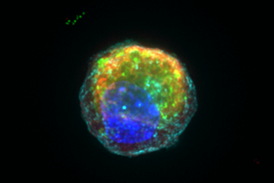 Researchers derived a single Paneth cell with anti-microbial granules in red and green from an adult intestinal stem cell.