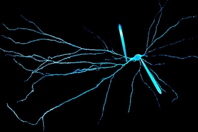 MIT neuroscientists can now record electrical activity from the dendrites of human neurons.