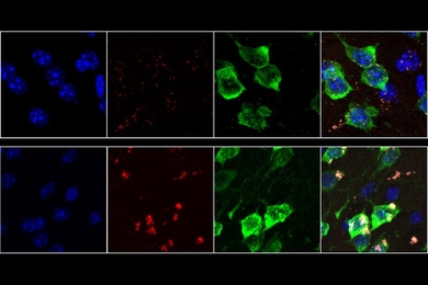 Neurons from 19-month-old mice (bottom row) show much higher rates of oxidative stress than neurons from 9-week-old mice (top row). Lipofuscin, a molecule associated with aging-related oxidative stress, appears red.