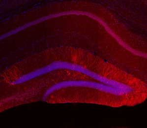 Red staining indicates expression of Kir2.1 potassium ion channels in dentate gyrus engram cells in the hippocampus of the brain.