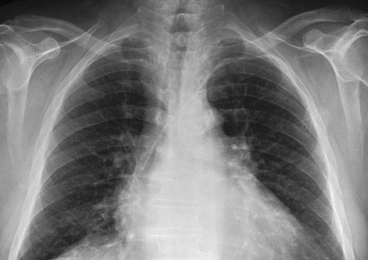 Researchers have released a repository of more than 350,000 detailed chest X-rays, which is free and open to academic, clinical, and industrial investigators.