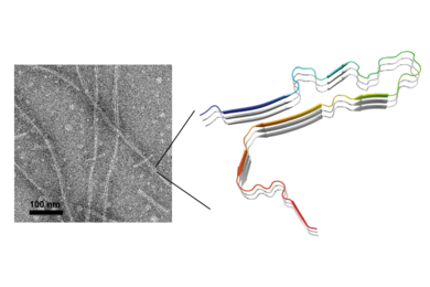 A solid-state nuclear magnetic resonance image reveals the three-dimensional fold of four-repeat tau protein in neurodegenerative diseases.