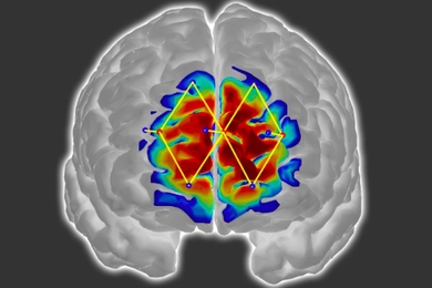 Researchers from MIT and elsewhere have developed a system that detects pain in patients by analyzing brain activity from a wearable neuroimaging device, which could help doctors diagnose and treat pain in unconscious and noncommunicative patients. 