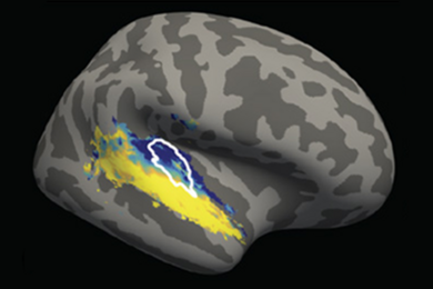 The primary region of the human auditory cortex (outlined in white) responds differently (blue) to natural sound when background noise is present.