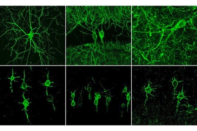 In the top row, neurons are labeled with a fluorescent probe that reveals electrical activity. In the bottom row, neurons are labeled with a variant of the probe that accumulates specifically in the neuron cell bodies, preventing interference from axons of neighboring neurons. 