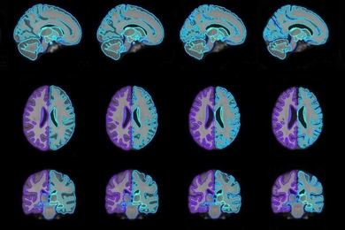 With their model, researchers were able to generate on-demand brain scan templates of various ages (pictured) that can be used in medical-image analysis to guide disease diagnosis. 