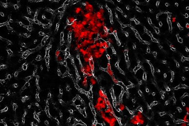 Small cell lung cancer (red) metastasizes to the liver in a genetically-engineered mouse model.