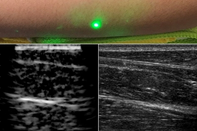 A new ultrasound technique uses lasers to produce images beneath the skin, without making contact with the skin as conventional ultrasound probes do. The new laser ultrasound technique was used to produce an image (left) of a human forearm (above), which was also imaged using conventional ultrasound (right).