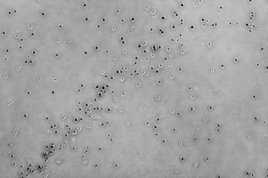A microscopic image shows a culture of C. difficile cells and spores. MIT research suggests the risk of becoming colonized increases immediately following gastrointestinal disturbances that result in diarrhea.